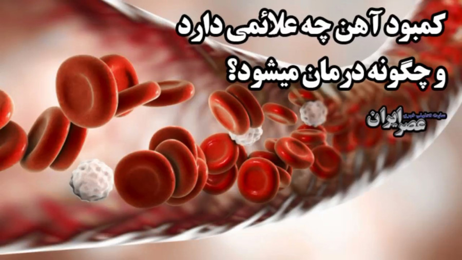 کمبود آهن چه علائمی دارد و چگونه درمان میشود ؟