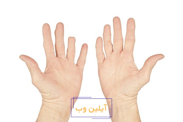 تعبیر خواب انگشت