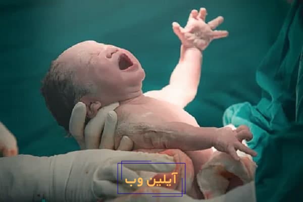 تعبیر خواب زایمان