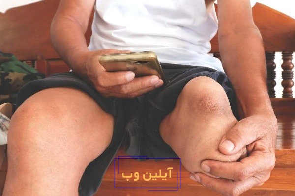 تعبیر خواب قطع شدن اعضای بدن